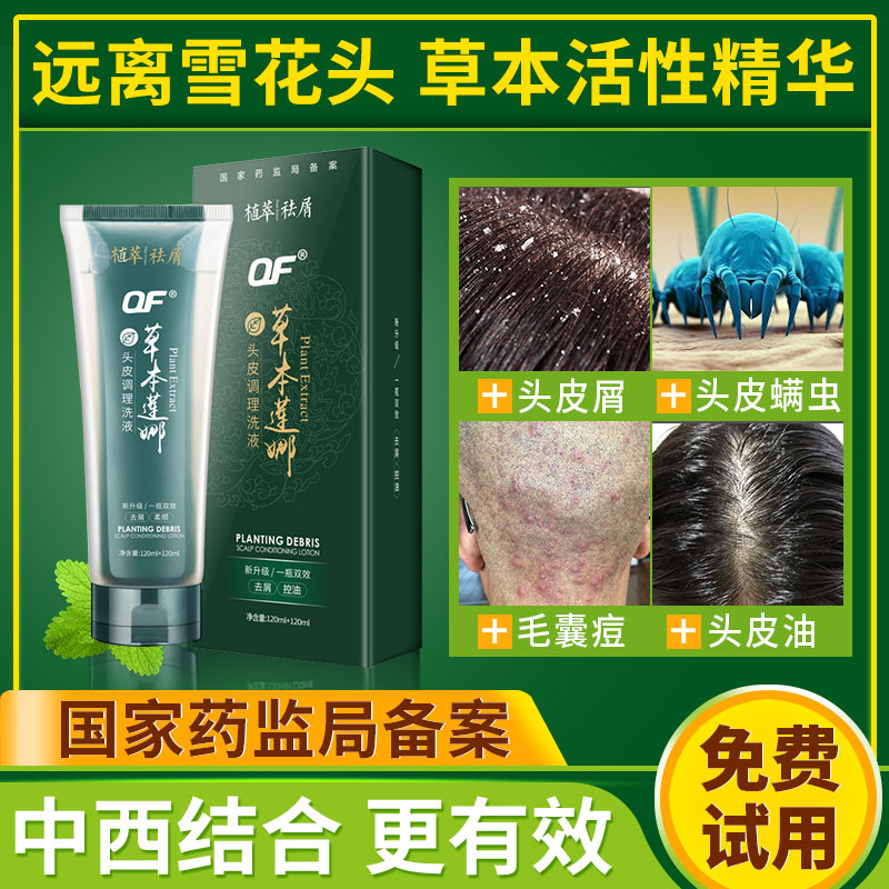 Herbal Lena Shampoo Dew to remove acne and mites, dandruff, antipruritic, oil, fluffy and clean scalp sterilization shampoo