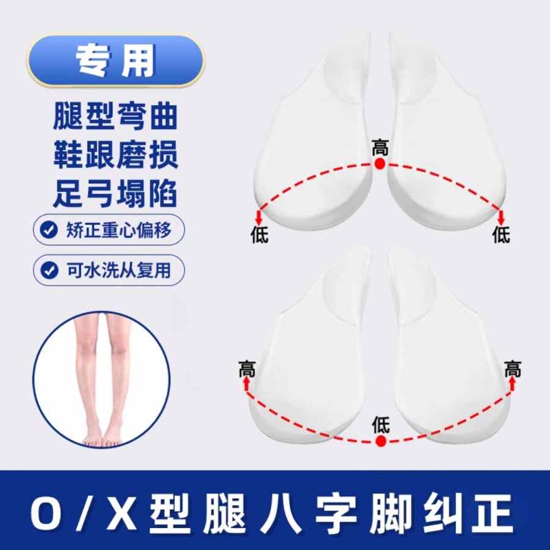 Adult Straight-Leg Corrector O-Type X-Type Calf Valgus Correction Insoles Flat Arch Support Pads to Prevent Shoe Sole Wear