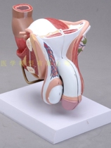 Pathological male internal reproductive anatomy model Lesion reproductive anatomy model Male urinary system disease model