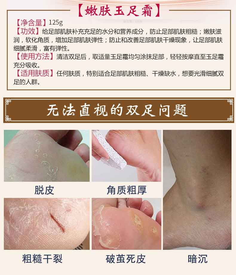 Anti 西 早 护 足 霜 足 裂 膏 Kem chống nứt chân chống ẩm tẩy tế bào chết chân