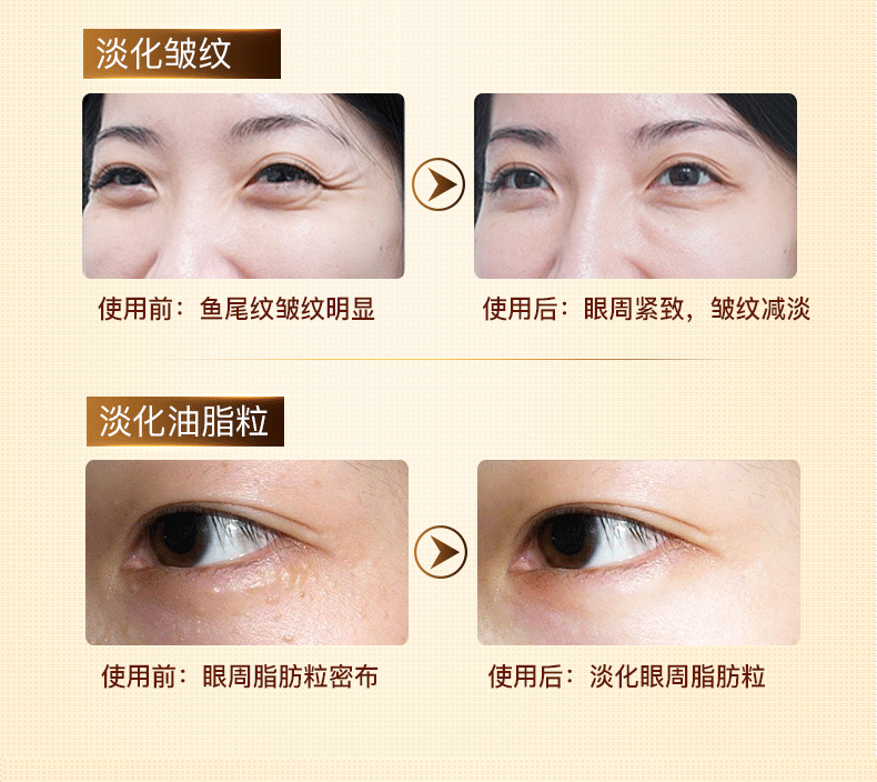 Nâng cao dưỡng chất làm săn chắc mắt cho mắt mặt nạ mắt trị thâm