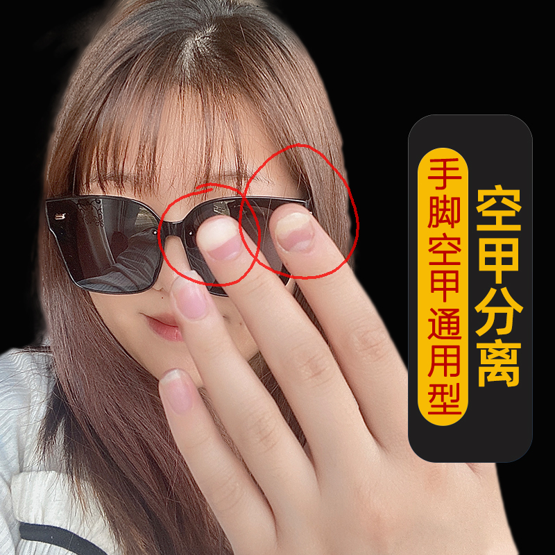 Quick Repair Nail Separation Special Care Solution Professionally Solves the Problem of Nail Layering and Restores Healthy Nail Color