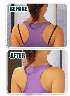 Fixation pour soutien-gorge - Ref 822468 Image 32