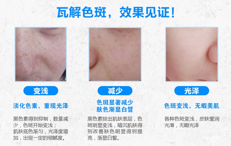 Bảy mặt nạ bột trắng làm trắng da mặt tàn nhang làm mềm ngọc trai để thẩm mỹ trị mụn thâm tím dành riêng cho thẩm mỹ viện Yu Rong San mặt nạ thải độc