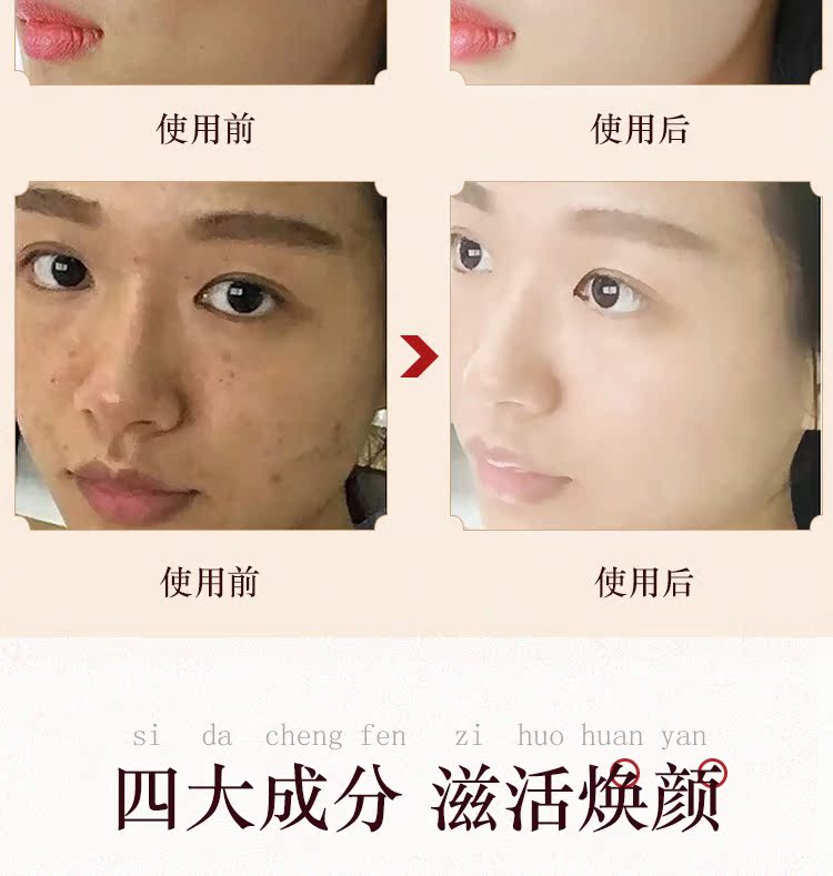 爱 cửa hàng chính thức chính thức trang web chính thức dán chân chăm sóc chân 10 miếng mỹ phẩm chăm sóc da nữ sinh viên kem làm mềm gót chân