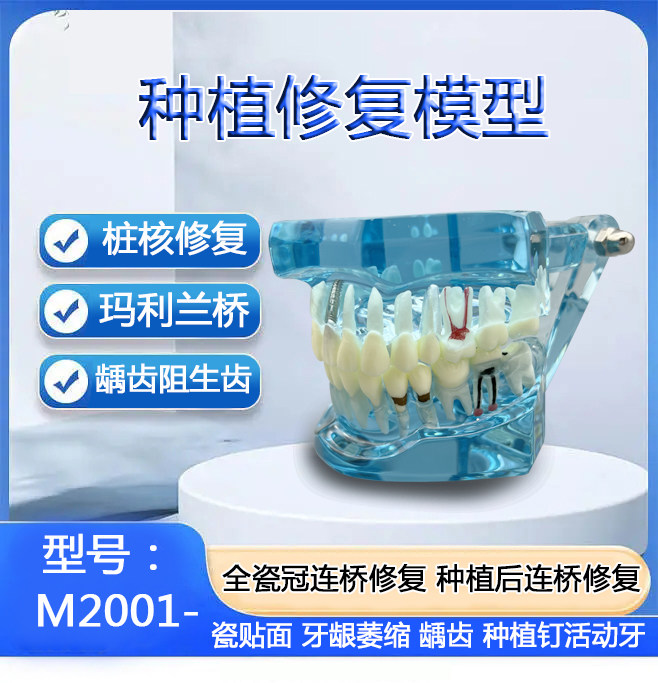 牙科口腔教学 蓝色种植与修复模型 可拆卸牙齿可拔龋坏阻生齿病理