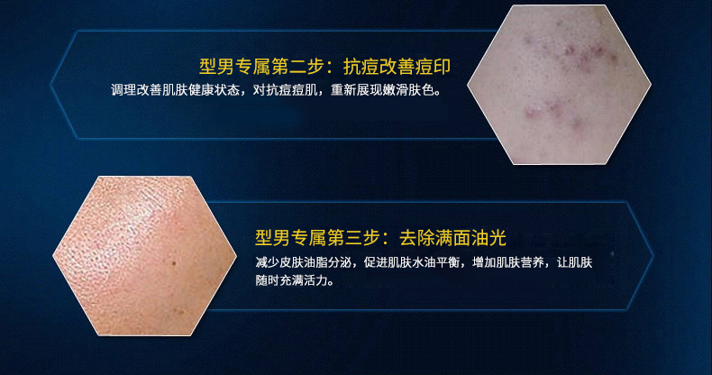 12 miếng mặt nạ dưỡng ẩm kiểm soát dầu Lan Kexin nam Kiểm soát thủy đậu để trị mụn đầu đen Chăm sóc và chăm sóc nam giới trắng da cho nam