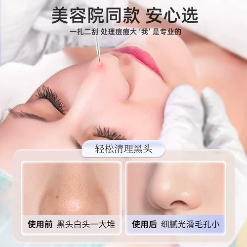 Пинцет от черных точек, косметический комплект из нержавеющей стали, Германия, 5 оттенок