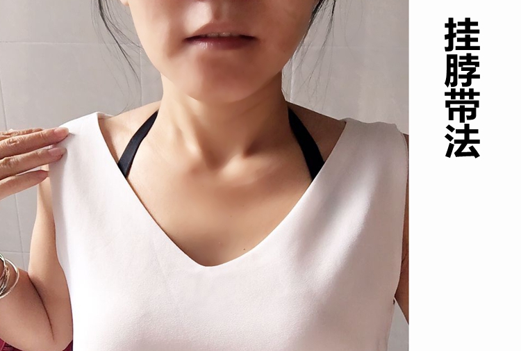 Mùa thu 2017 cộng với vẻ đẹp dày dày trở lại chéo dây đeo áo ngực có cổ treo dây đeo áo ngực vô hình với chống trượt dây đeo áo bra