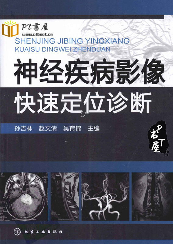 神经疾病影像快速定位诊断 Book Cover