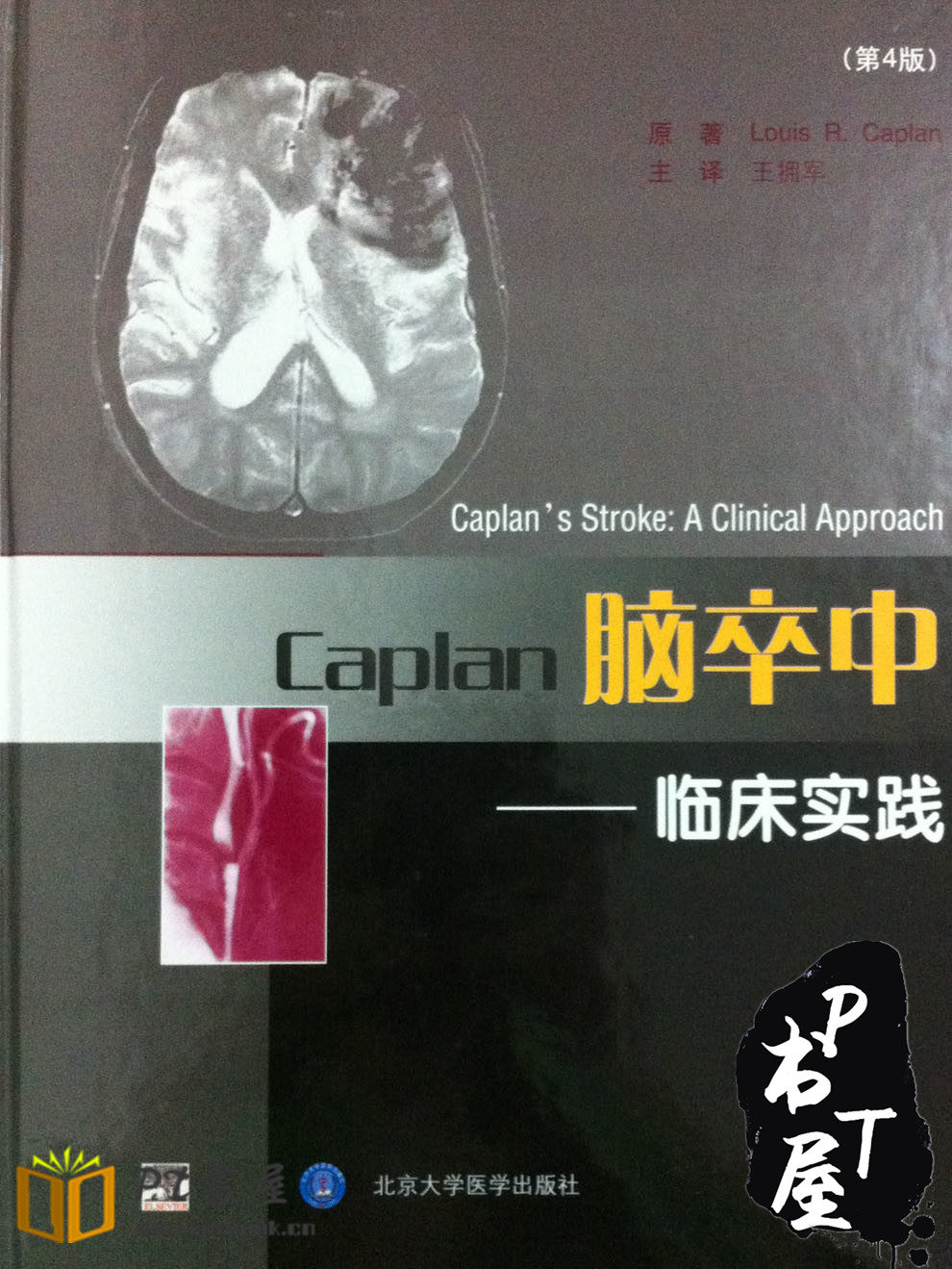 Caplan脑卒中 临床实践 第4版 Book Cover