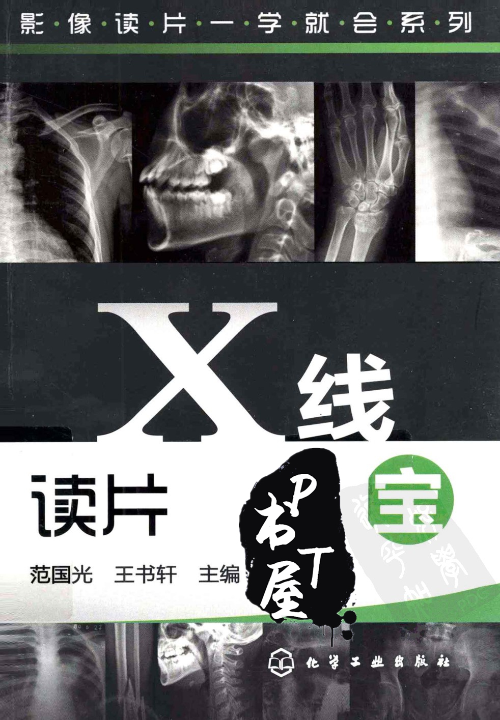 X线读片掌中宝 Book Cover