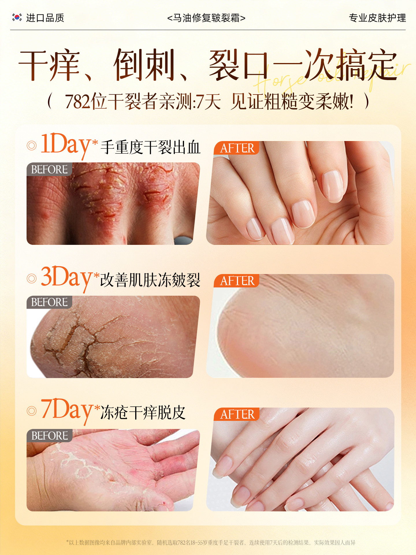 Horse Oil Ointment for Cracked Heels, Repair Cream for Hard Skin, Heel Crack Repair, Snake Oil Hand Cream, Foot Care, Moisturizing for Chapped Skin in Winter