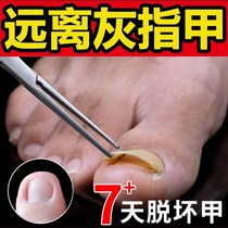 Chia Yikang parathicchia refers to raw source grey nail Liu guan nnet Mr. Guan Chia bacteriostatic agent Yan Iwakkongrimpani