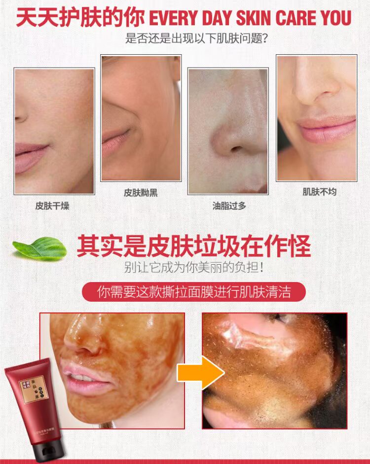 Mặt nạ rách làm sạch sâu lỗ chân lông hydrat nam và nữ mặt rách mặt hút mụn đầu đen đến mặt bẩn các loại mặt nạ trắng da