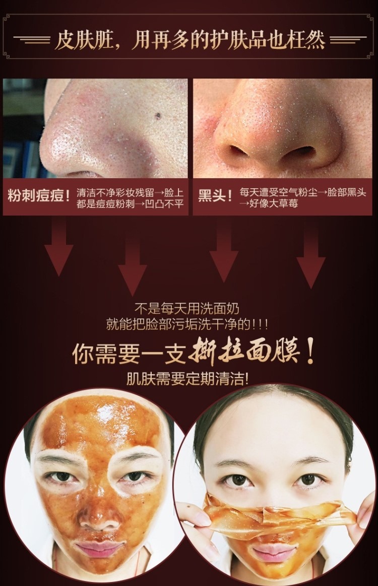 Mặt nạ rách làm sạch sâu lỗ chân lông hydrat nam và nữ mặt rách mặt hút mụn đầu đen đến mặt bẩn các loại mặt nạ trắng da