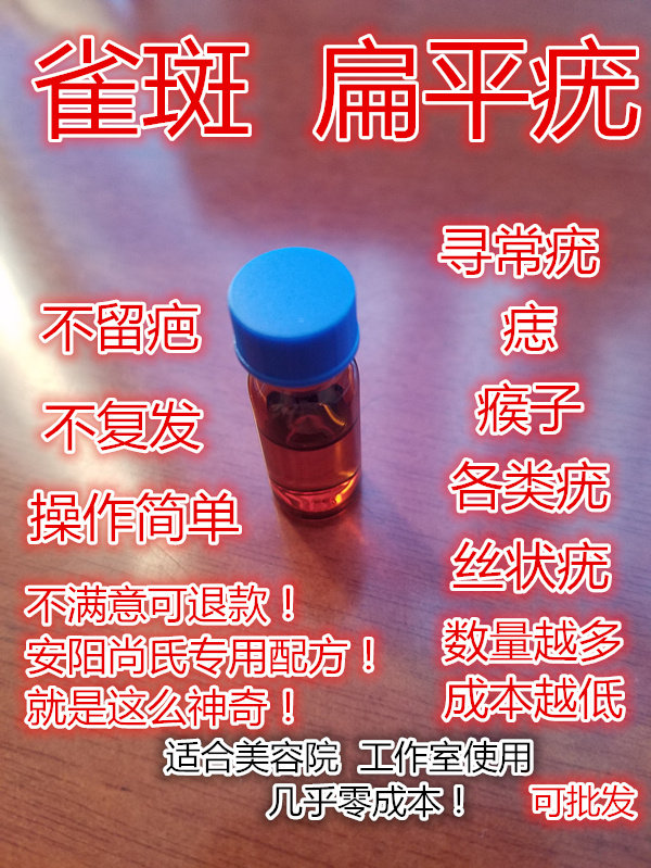 Shang's Traditional Chinese Medicine Remove Flat Wart Removal Mole Removal Liquid Freckle Liquid Spotting Water Spot Mole Water Beauty Salon Extract