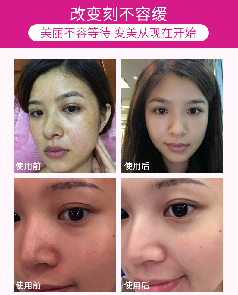 Qiao Yanni tẩy tế bào chết Facial Deep Cleansing Cream Toxin Facial Cleansing lỗ chân lông Detox Massage Cream chính hãng kem massage mặt spa