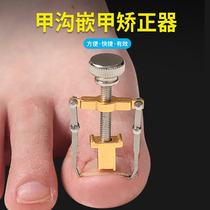 The nail groove enameling appliance toenail foot groove foot positive nail correction device correction fingernail inflammation long meat artifact