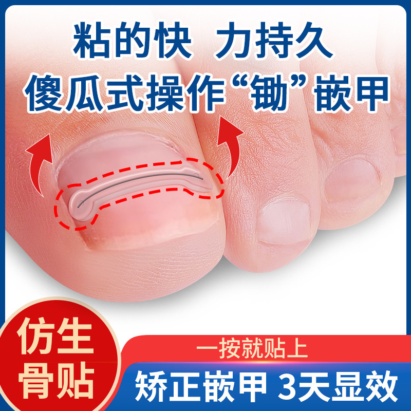 Ingrown Toenail Corrector, Nail Patch, Ingrown Toenail Correction Pad, Toenail Correction Pad for Toenails Growing into the Flesh