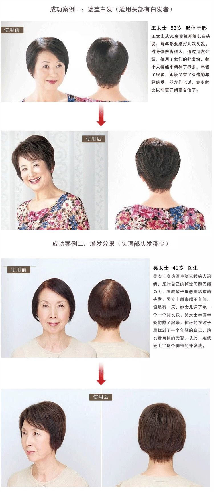 Extension cheveux - Ref 226323 Image 19