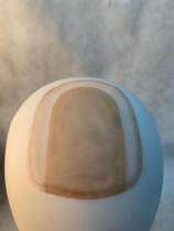 Hair block replacement bangs ultrasonic network super realistic super invisible needle delivery network