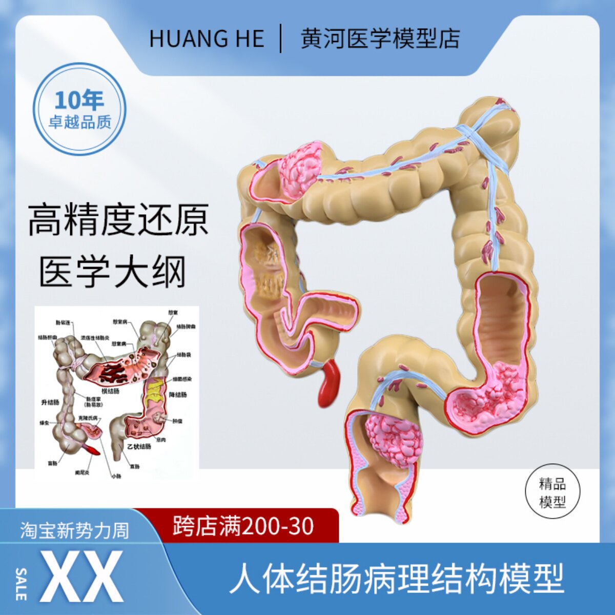 大肠病变病理解剖模型肠道疾病人体结肠病变模型人体器官解剖模型