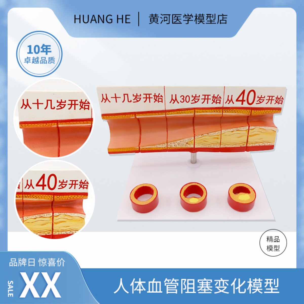 人体血管模型动脉血管阻塞变化演示教学模型器官解剖结构层次模型