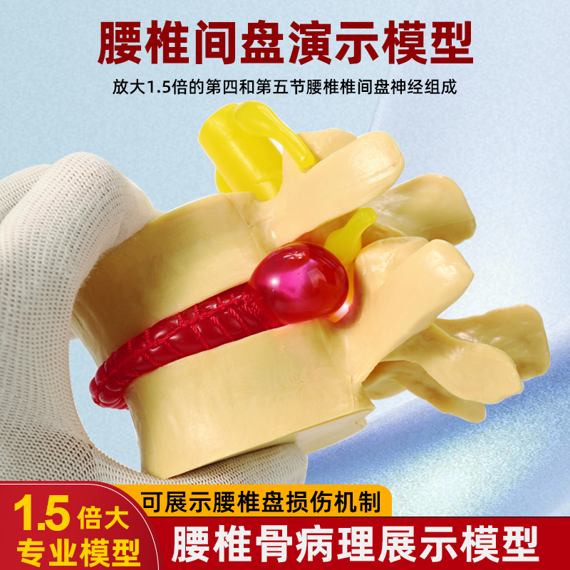 包邮!人体腰椎间盘演示模型腰椎模型脊柱模型脊椎模型关节模型-淘宝