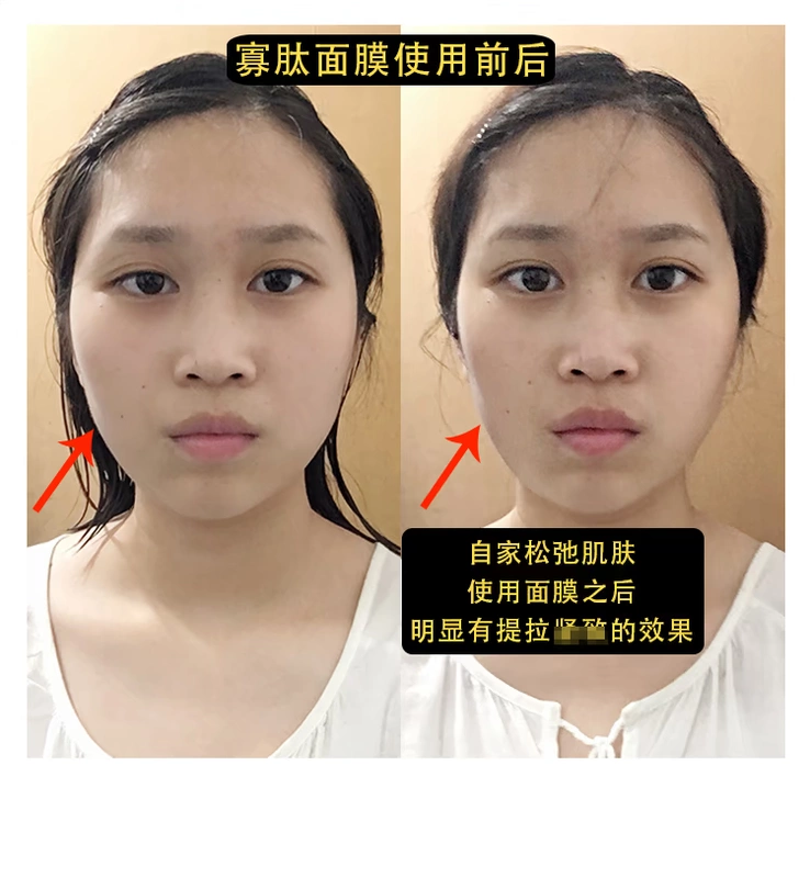 SU3 EVM oligopeptide tinh chất hyaluronic acid dưỡng ẩm làm săn chắc da mặt nữ sửa chữa giữ ẩm nam sinh viên phụ nữ mang thai chất lỏng ban đầu - Mặt nạ