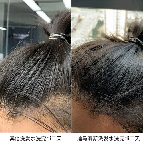 Шампунь для кожи головы, Германия, удаление перхоти, против зуда, долговременный эффект, контроль жирного блеска, 300 мл