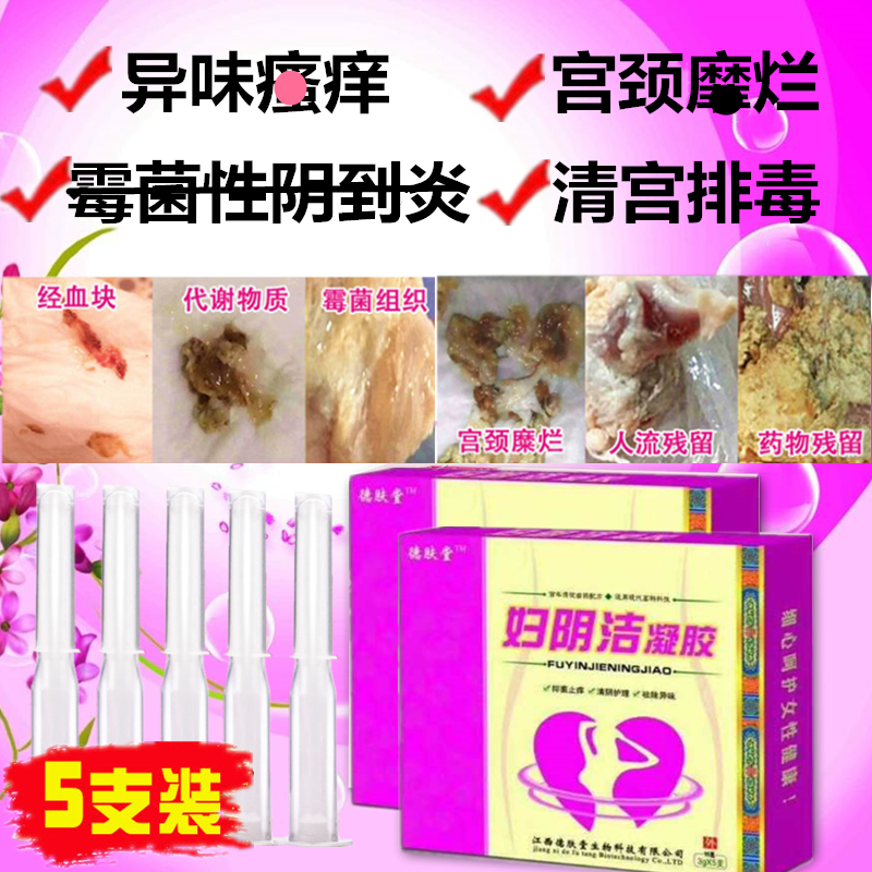 Gynecological Vaginal Itch to Peculiar Smell Private white with medicine Candida Candida perineum perineum perineum tofu slag Toxin Care