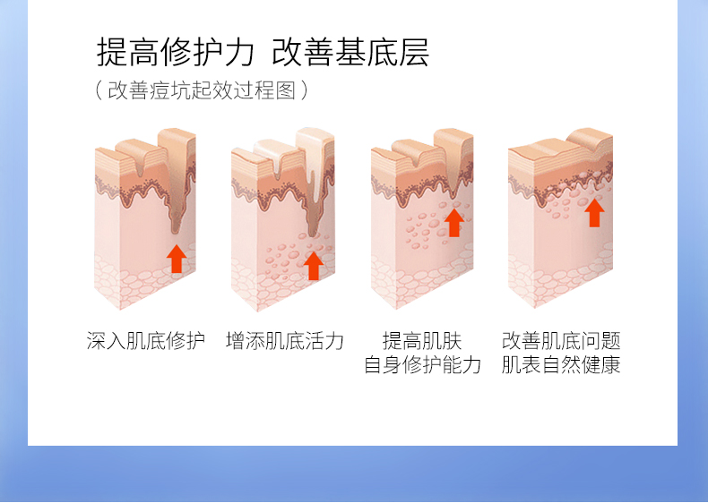 Đầu mùa hè bột đông khô oligopeptide chất lỏng pha loãng mụn trứng cá lỗ chân lông thu nhỏ lỗ chân lông trên khuôn mặt đàn ông đích thực serum 9wishes