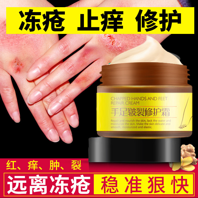 马油冻疮膏护手霜非特效速效冻必治脚后跟干裂防冻裂霜止痒冻伤冬
