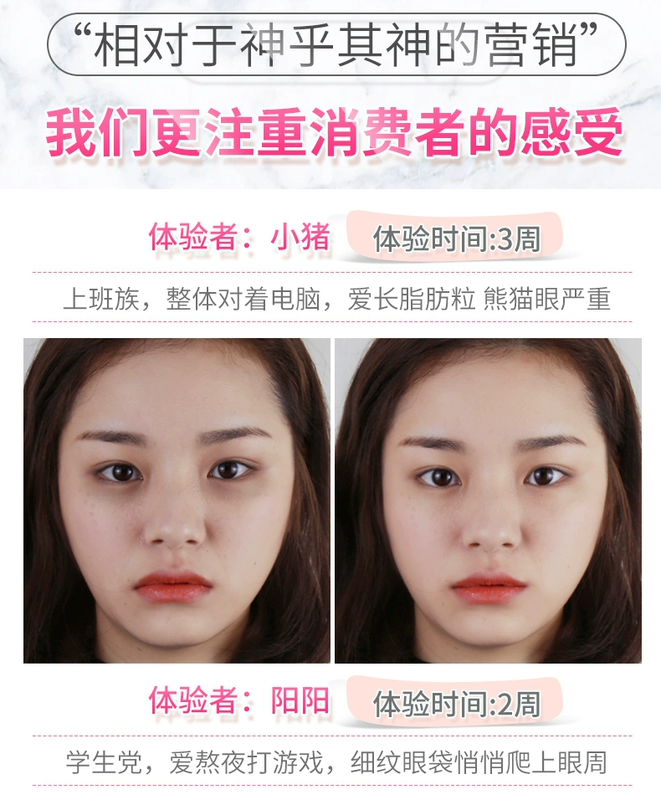 Tujia Selenium Mud Eye Cream Desalination Dark Circle Eye Bag Fine Line Replenishing Nâng cơ Firming Eye Essence Eye Care