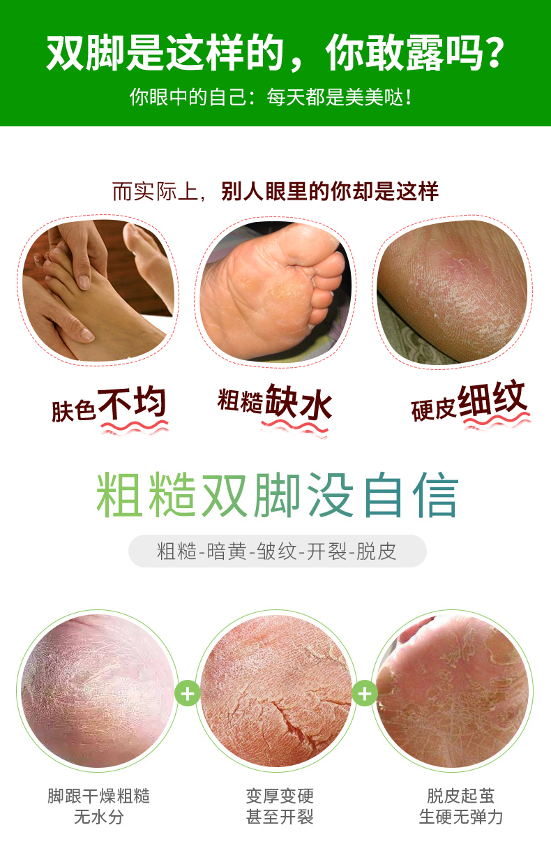 Hồng Kông nhập khẩu MINFOOT hấp dẫn Bộ phim làm đẹp chân Ai Ai sửa chữa chăm sóc mặt nạ chân chăm sóc 3 chân dưỡng da chân