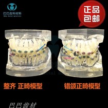 Wrong jaw correction display model Zast bracket orthodontic oral model Transparent tooth model Dental teaching model