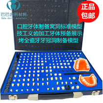 Oral dental preparation model tooth preparation cave denture processing model technical dental preparation display model