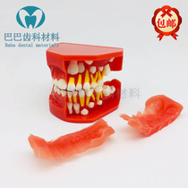 Dental Oral Model 5-9 Year Old Breast Tooth Alternate Display Model Presentation Teaching Communication Child Replacement Model