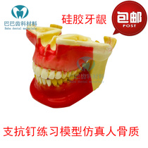 Dental oral practice implant model anchorage nail practice model foam simulation bone 2031 oral training