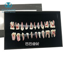 Oral Milk Tooth Deconplaning Display Model Children Tooth Root Canal Medullary presentation Dairy Tooth Knowledge Explanation