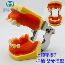 Dental dentist exercises maxillary sinus lifting mandibular implant model incision suture implant model