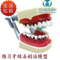 Dental Oral Teaching Periodontal model dental calculus scraping and curing the gingival contraction practice scraping 