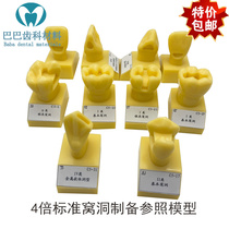 Dental 4 times larger cavity preparation reference model 4 times the tooth preparation standard demonstration inlay hole type