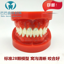 Dental Spare Teeth Model Standard Tooth Model Students Practice Orthodontic Training Togroove Bonding Aesthetic Repair