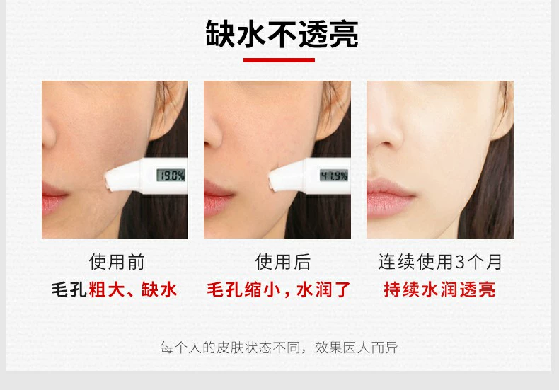Dongyi Qiwei Chamomile Mask Hydrating Repair Red So nhẹ Moisturising Sensitive Skin Special Bloodshot Female - Mặt nạ