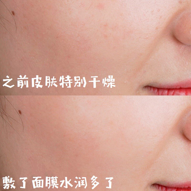 �����ٸ�Ҳ�����ˣ�������Ĥ��Ѫ���ͼ10
