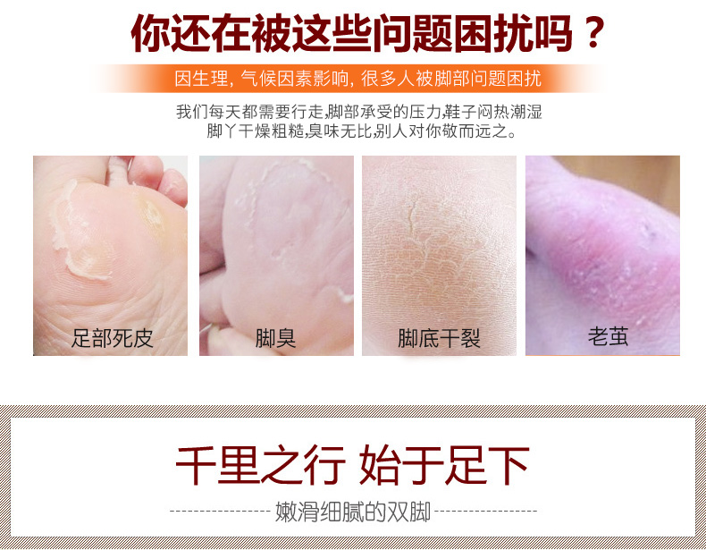 Ou Liyuan chân tẩy tế bào chết chà để chết da cũ dịu dàng dịu dàng chân kem chân chăm sóc bàn chân 200 gam x 2 chai kem nứt gót chân