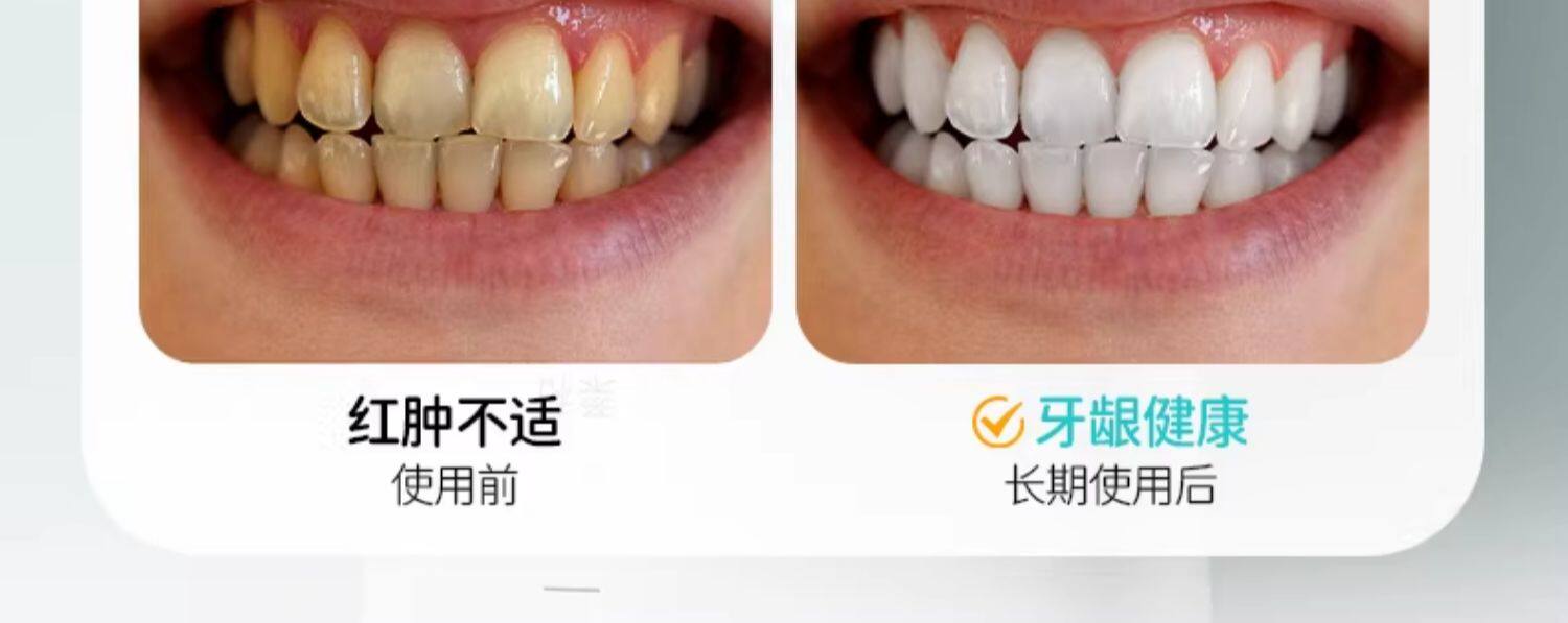 叶酸准孕妇牙膏缓解孕吐孕期月子可专用清新口气去黄去口臭不含氟 — 21