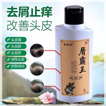 Malassezia shampoo to remove dandruff tinea capitis and tinea external scalp